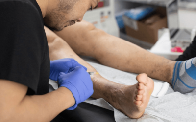 How To Choose The Right Vein Doctor?