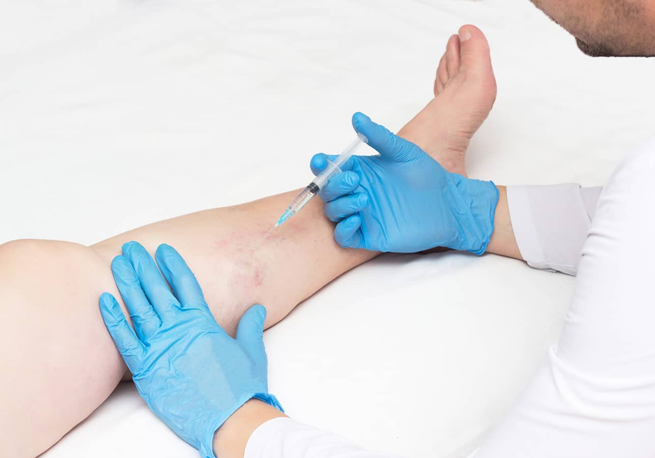 What Are The Right Doctors in New York for Varicose Vein Concerns?