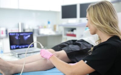 The Best Vein Treatment in New York City