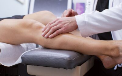 Best Treatment for Spider Veins in Brighton Beach, NY