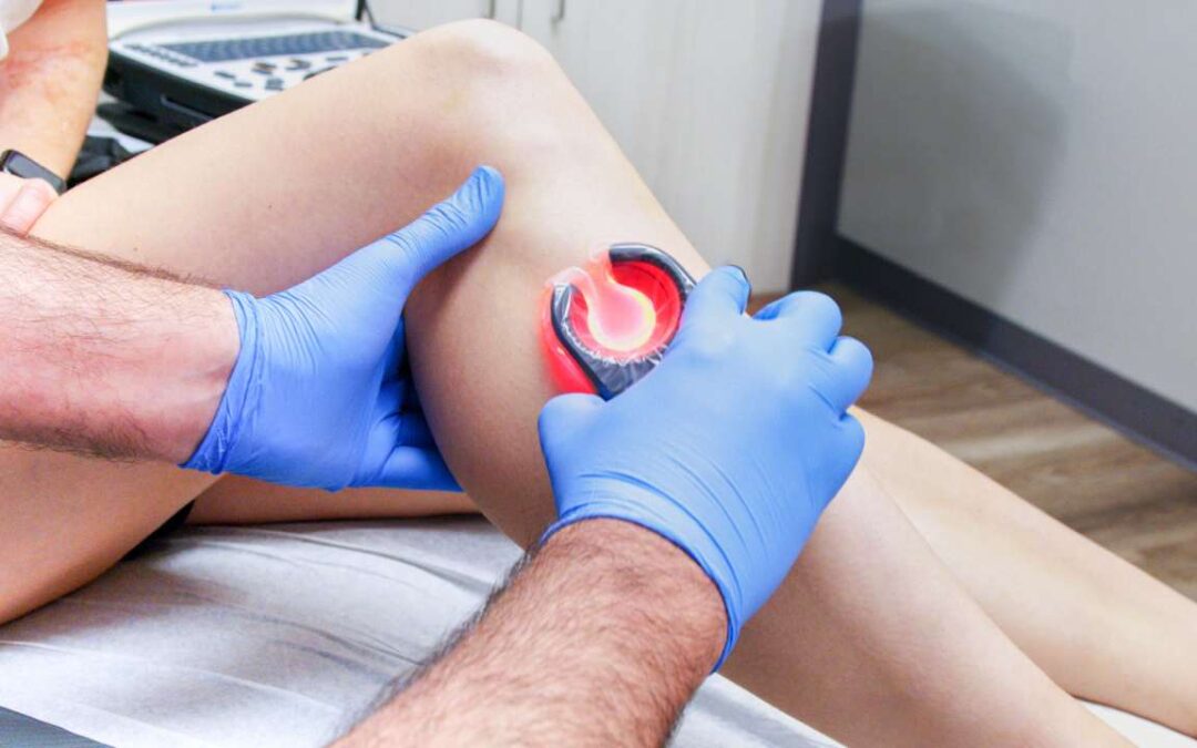 Best Treatment Options for Spider Veins in Bronx, New York