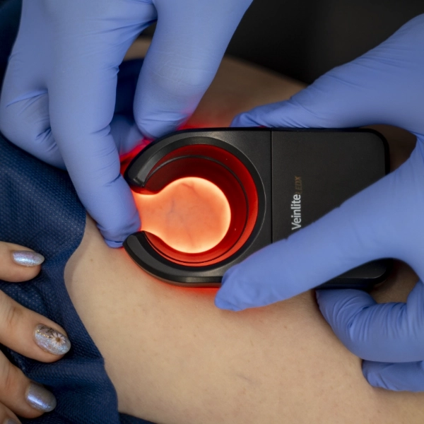 What does a vein clinic do